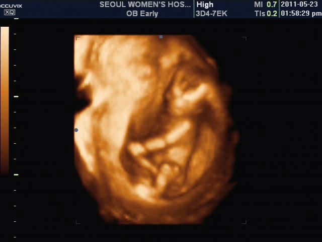 20110**4*24*17U-2100235**7*00*62-7039411054.JPG