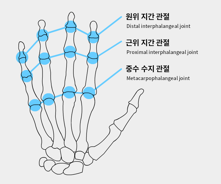 joints.png